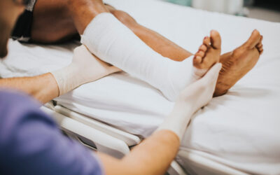 A Maryland auto accident can cause multiple fractures with months of recovery