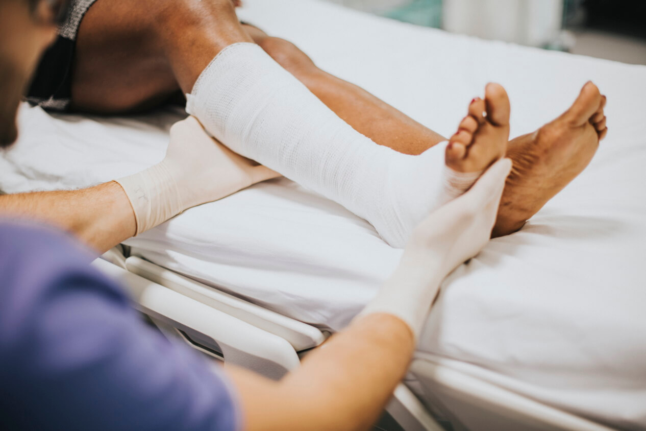 A Maryland auto accident can cause multiple fractures with months of recovery